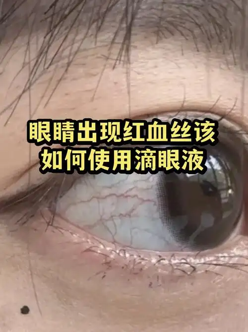 眼镜侠逆袭：双C视野神器成LPL夏季赛最强黑科技